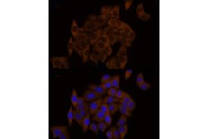 Immunofluorescence analysis of HeLa cells using GSDMD (Full Length+N terminal) Rabbit pAb (ABIN7267351) at dilution of 1:150 (40x lens). (GSDMD anticorps  (AA 154-252))
