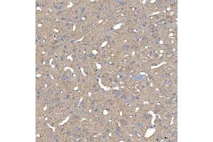 IHC analysis of SLC25A23 using anti-SLC25A23 antibody (ABIN7600165).