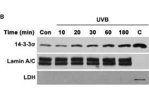 AKT cooperates with 14-3-3σ to facilitate nuclear translocation of TC45 in response to UVB irradiationWestern blot analysis of A.