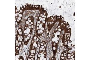 Immunohistochemical staining of human colon with VPS37B polyclonal antibody  shows strong cytoplasmic positivity in glandular cells.