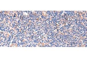 Immunohistochemistry of paraffin-embedded Human tonsil tissue using ZNF256 Polyclonal Antibody at dilution of 1:120(x200) (ZNF256 anticorps)
