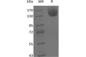 Western Blotting (WB) image for Leptin Receptor (LEPR) protein (Fc Tag) (ABIN7320922) (Leptin Receptor Protein (LEPR) (Fc Tag))