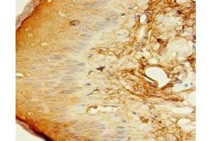 Immunohistochemistry of paraffin-embedded human skin tissue using ABIN7148341 at dilution of 1:100