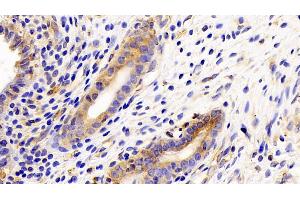 Detection of gp130 in Rat Uterus Tissue using Polyclonal Antibody to Glycoprotein 130 (gp130) (CD130/gp130 anticorps  (AA 26-323))