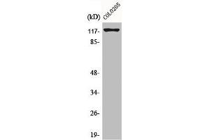 Western Blot analysis of COLO205 cells using Eg5 Polyclonal Antibody (KIF11 anticorps  (Thr926))