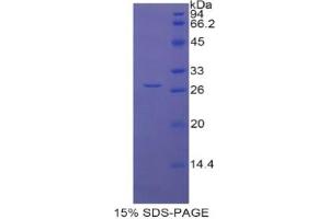 SDS-PAGE analysis of Rat LOXL1 Protein. (LOXL1 Protéine)