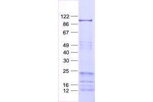 Validation with Western Blot