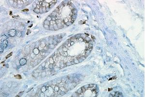 Immunohistochemistry analysis using Mouse Anti-Hsp90 Monoclonal Antibody, Clone H9010 (ABIN361717 and ABIN361718).