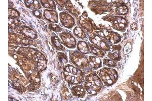 IHC-P Image 14-3-3 zeta antibody detects 14-3-3 zeta protein at cytosol on mouse colon by immunohistochemical analysis.