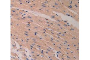 IHC-P analysis of heart tissue, with DAB staining. (LAMB2 anticorps  (AA 1498-1716))