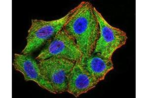 Immunofluorescence analysis of Hela cells using TRIM25 mouse mAb (green).