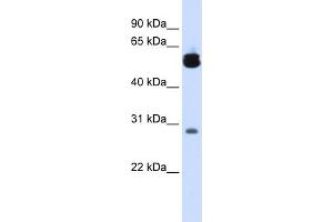 WB Suggested Anti-YWHAZ Antibody Titration:  0. (14-3-3 zeta anticorps  (Middle Region))