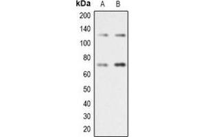 Western blot analysis of RAD21 expression in Jurkat (A), A431 (B) whole cell lysates. (RAD21 anticorps  (C-Term))