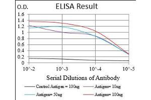 Black line: Control Antigen (100 ng), Purple line: Antigen(10 ng), Blue line: Antigen (50 ng), Red line: Antigen (100 ng),