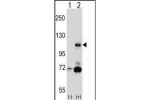 Western blot analysis of PIK3CB (arrow) using rabbit polyclonal PIK3CB Antibody (N-term ) (ABIN652426 and ABIN2842105).