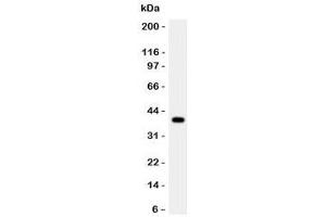 Western blot testing of Cathepsin G antibody and rat thymus lysate. (Cathepsin G anticorps  (AA 76-255))