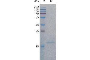 Interleukin 4 (IL4) (AA 25-153) protein (His tag)