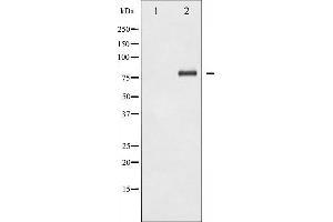 Western blot analysis of NF- kappaB p65 phosphorylation expression in HeLa whole cell lysates,The lane on the left is treated with the antigen-specific peptide.