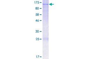 Image no. 1 for Optic Atrophy 1 (Autosomal Dominant) (OPA1) (AA 1-960) protein (GST tag) (ABIN1313399)
