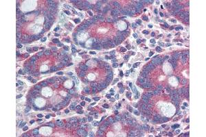 Immunohistochemistry (IHC) image for anti-Yes-Associated Protein 1 (YAP1) (C-Term) antibody (ABIN2784221)