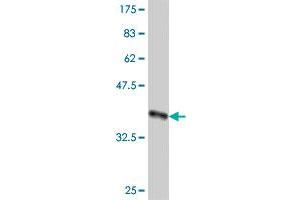 Western Blot detection against Immunogen (37. (CAND1 anticorps  (AA 1-100))