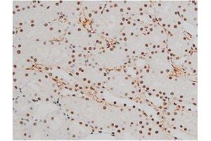 ABIN6267389 at 1/200 staining Rat kidney tissue sections by IHC-P.