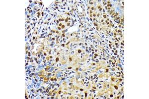Immunohistochemistry of paraffin-embedded rat ovary using ENT2/SLC29 Rabbit mAb (ABIN7270448) at dilution of 1:100 (40x lens).