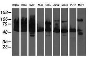 Image no. 2 for anti-Dihydrolipoamide Dehydrogenase (DLD) antibody (ABIN1497850) (DLD anticorps)