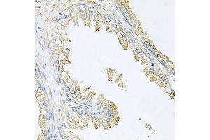 Immunohistochemistry of paraffin-embedded human prostate using PPP3R1 antibody.