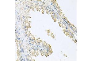 Immunohistochemistry of paraffin-embedded human prostate using PPP3R1 antibody. (PPP3R1 anticorps  (AA 11-170))