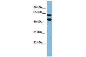 PH4 antibody used at 1 ug/ml to detect target protein. (P4HTM anticorps  (Middle Region))