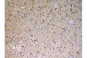 IHC analysis of Sacsin using anti-Sacsin antibody .