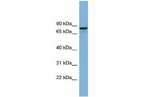 WB Suggested Anti-GGA3 Antibody Titration: 0. (GGA3 anticorps  (N-Term))