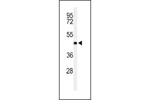 Western blot analysis of RPR1B Antibody (C-term) (ABIN653874 and ABIN2843125) in Jurkat cell line lysates (35 μg/lane).