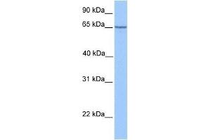Western Blot showing PML antibody used at a concentration of 1. (PML anticorps  (C-Term))