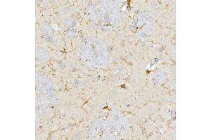 Immunohistochemistry of paraffin-embedded rat heart using TOM20 Rabbit mAb (ABIN7268554) at dilution of 1:100 (40x lens).