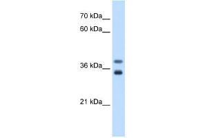 GDE1 antibody used at 0. (GDE1 anticorps  (N-Term))