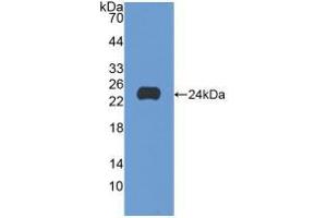 Western blot analysis of recombinant Human SCFR. (KIT anticorps  (AA 321-520))
