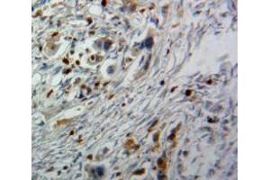 IHC-P analysis of Pancreas tissue, with DAB staining. (CDK9 anticorps  (AA 104-315))