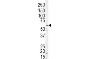 Western blot analysis of NRG1 antibody and SK-BR-3 lysate.