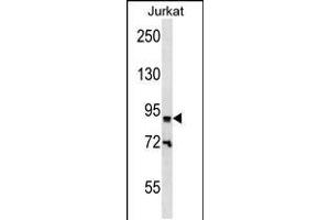 Western blot analysis in Jurkat cell line lysates (35ug/lane). (ZNF780B anticorps  (N-Term))