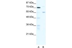 WB Suggested Anti-FOXJ2 Antibody Titration:  0. (Forkhead Box J2 anticorps  (N-Term))