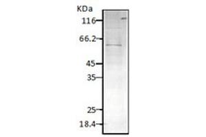 Western blot analysis of Parasite Lysates showing detection of HSP60 protein using Rabbit Anti-HSP60 Polyclonal Antibody .