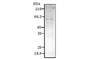 Western blot analysis of Parasite Lysates showing detection of HSP60 protein using Rabbit Anti-HSP60 Polyclonal Antibody . (HSPD1 anticorps  (Atto 390))