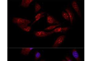 Confocal immunofluorescence analysis of U-2OS cells using EIF6 Polyclonal Antibody at dilution of 1:50.