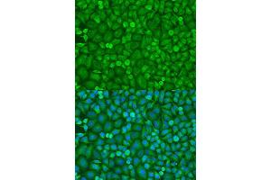 Immunofluorescence analysis of U2OS cells using EIF4E antibody.