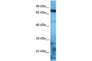 Host:  Rabbit  Target Name:  ZSC12  Sample Type:  RPMI-8226 Whole Cell lysates  Antibody Dilution:  1. (ZSC12 anticorps  (N-Term))