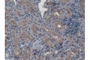 Detection of HIF1a in Porcine Kidney Tissue using Polyclonal Antibody to Hypoxia Inducible Factor 1 Alpha (HIF1a)