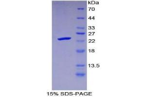 SDS-PAGE analysis of Human Protease, Serine 1 Protein. (Protease (Ser1) Protéine)