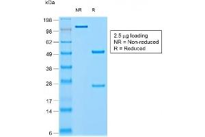 SDS-PAGE Analysis of Purified CHGA Mouse Recombinant Monoclonal Antibody ABIN6383803.